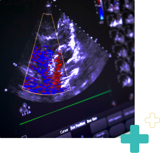 echocardiogram of patient in Houston