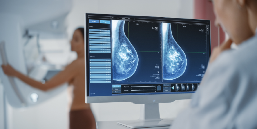 mammogram imaging 