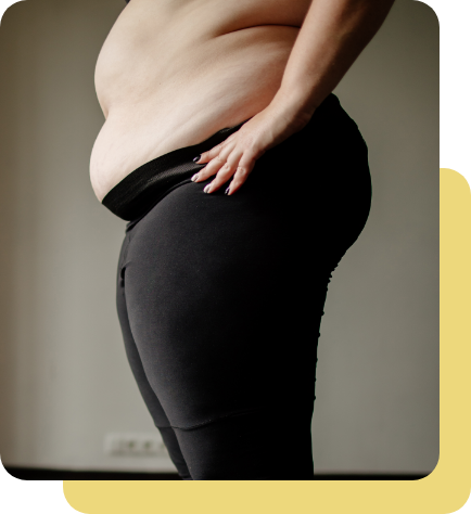 woman dealing with excess weight